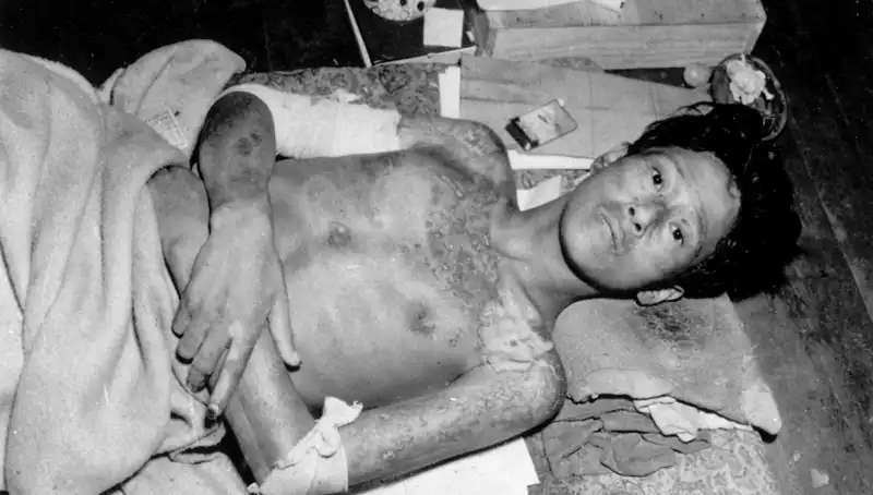 80 Yıl Sonra Nagasaki'den Nükleer Felakete Dikkat Çeken Çağrı