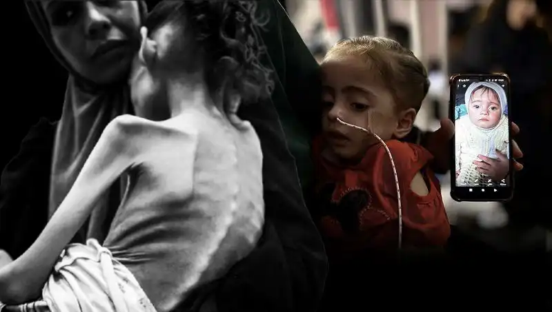 Küçük Meryem’in Açlıkla Mücadelesi: 25 Kilodan 10 Kiloya Düşüşü İle Dikkat Çekiyor